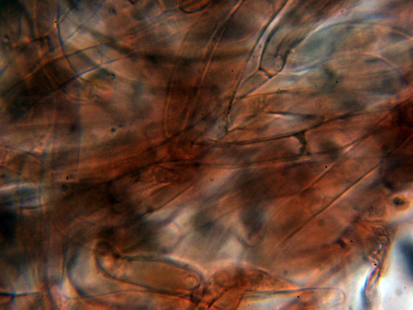 Microscopía de Melanoleuca graminicola - 10 - Suprapellis 3